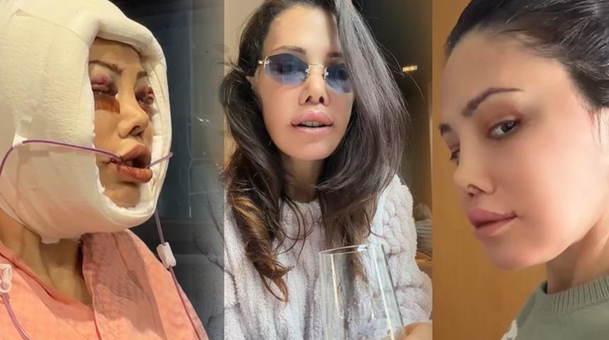 Kore'de y&uuml;z nakli yaptırmıştı! Didem Ceran 'Saklamak istemiyorum' diyerek hastalığını a&ccedil;ıkladı