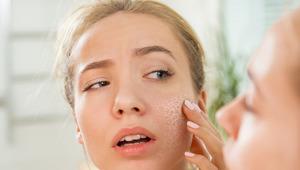 T&uuml;m yılı etkileyecek hataları a&ccedil;ıkladı: Ramazan'da cilt bakımı nasıl yapılır? 