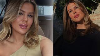 Mehmet Ali Erbil ile boşanmasının ardından değişime başladı! Gülseren Ceylan dolgularını eritti