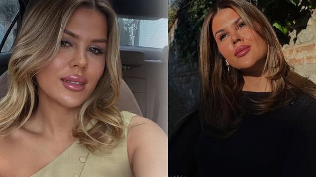 Mehmet Ali Erbil ile boşanmasının ardından değişime başladı! Gülseren Ceylan dolgularını eritti