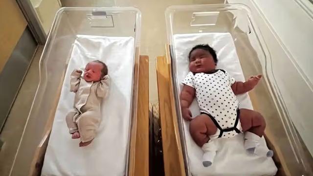 Rekor kıran doğum: Yenidoğan bebek tarihe ge&ccedil;ti!