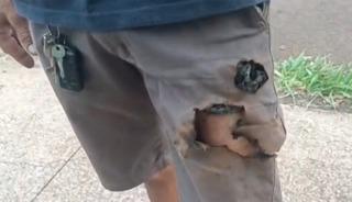 K&ouml;pekler saldırdı, cebindeki telefon hayatını kurtardı!