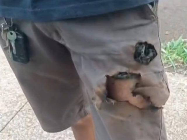 K&ouml;pekler saldırdı, cebindeki telefon hayatını kurtardı!