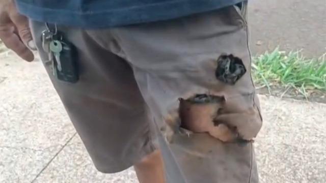 Köpekler saldırdı: Cebindeki telefon hayatını kurtardı!