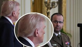 Trump'ın boynundaki morluklar g&uuml;ndem oldu!