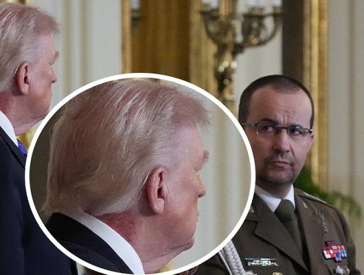 Trump'ın boynundaki morluklar g&uuml;ndem oldu!