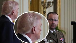 ABD Başkanı Trump'ın boynundaki kızarıklık gündem oldu! Daha önce ellerinde olmuştu
