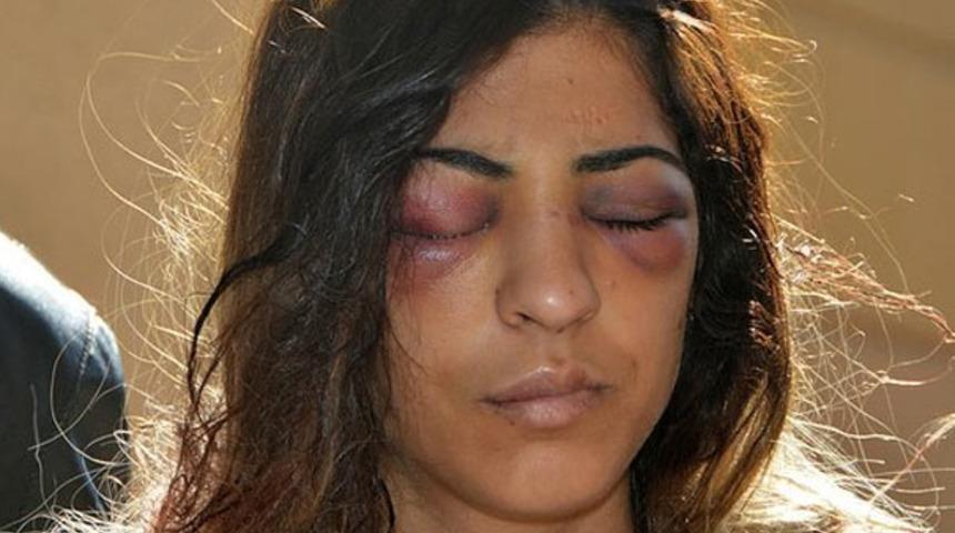 Genç kadını bu hale getirdi! Bir eliyle boğazını sıktı, diğeriyle de…