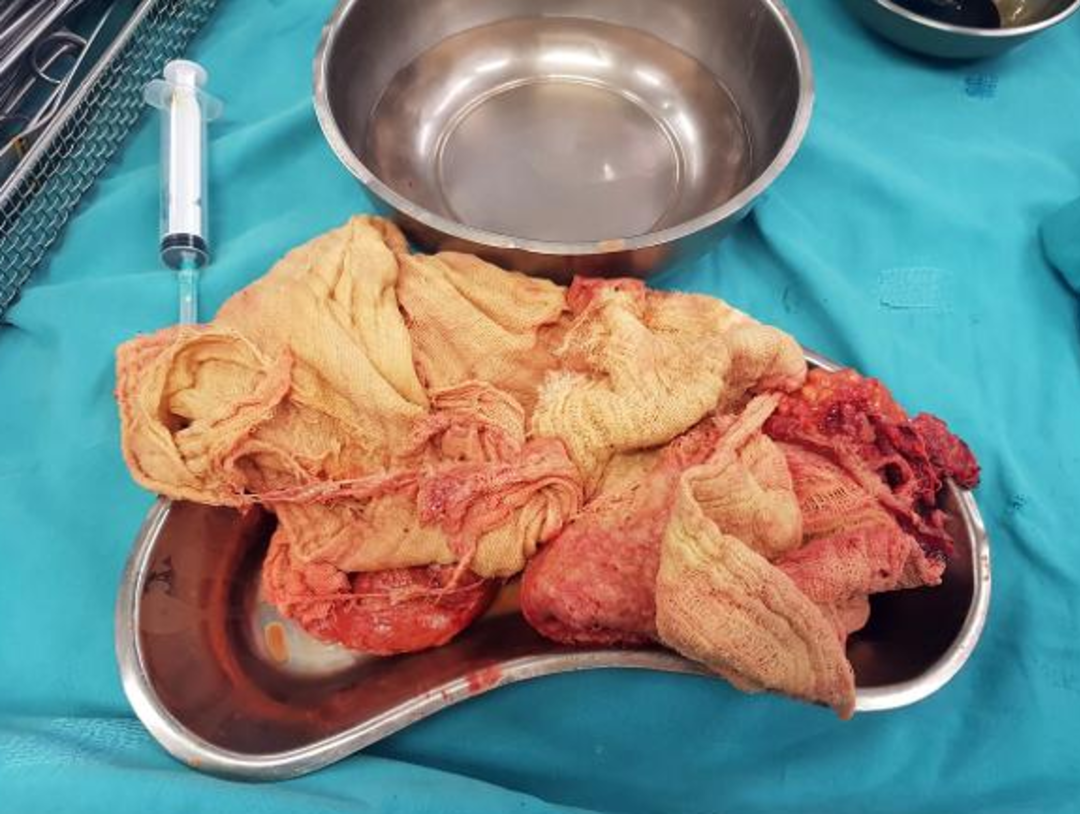 Kist sanılan kitle bakın ne &ccedil;ıktı