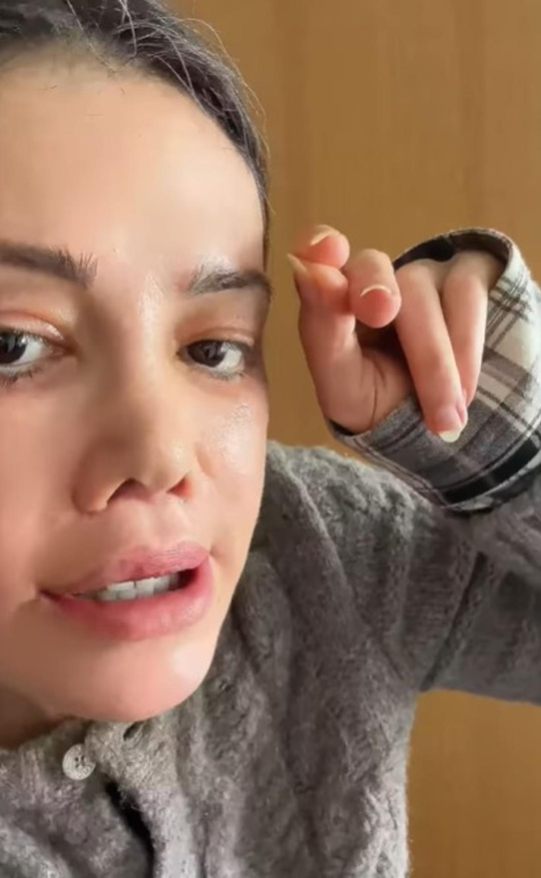 Y&uuml;z nakli yaptırmıştı! Didem Ceran ın kaşında sa&ccedil; &ccedil;ıktı! Kimse inanamadı  3