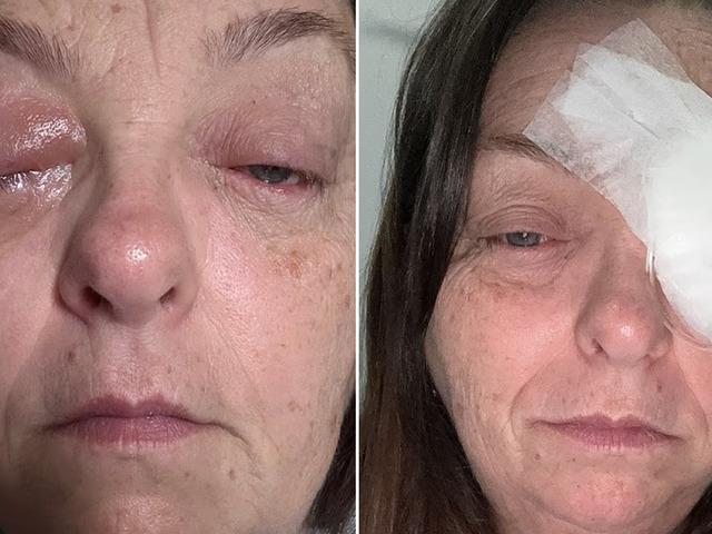 G&ouml;z&uuml;ndeki siyah noktayı sinek sandı, ger&ccedil;ek daha korkun&ccedil; &ccedil;ıktı! 