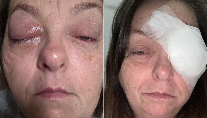 G&ouml;z&uuml;ndeki siyah noktayı sinek sandı, ger&ccedil;ek daha korkun&ccedil; &ccedil;ıktı! 