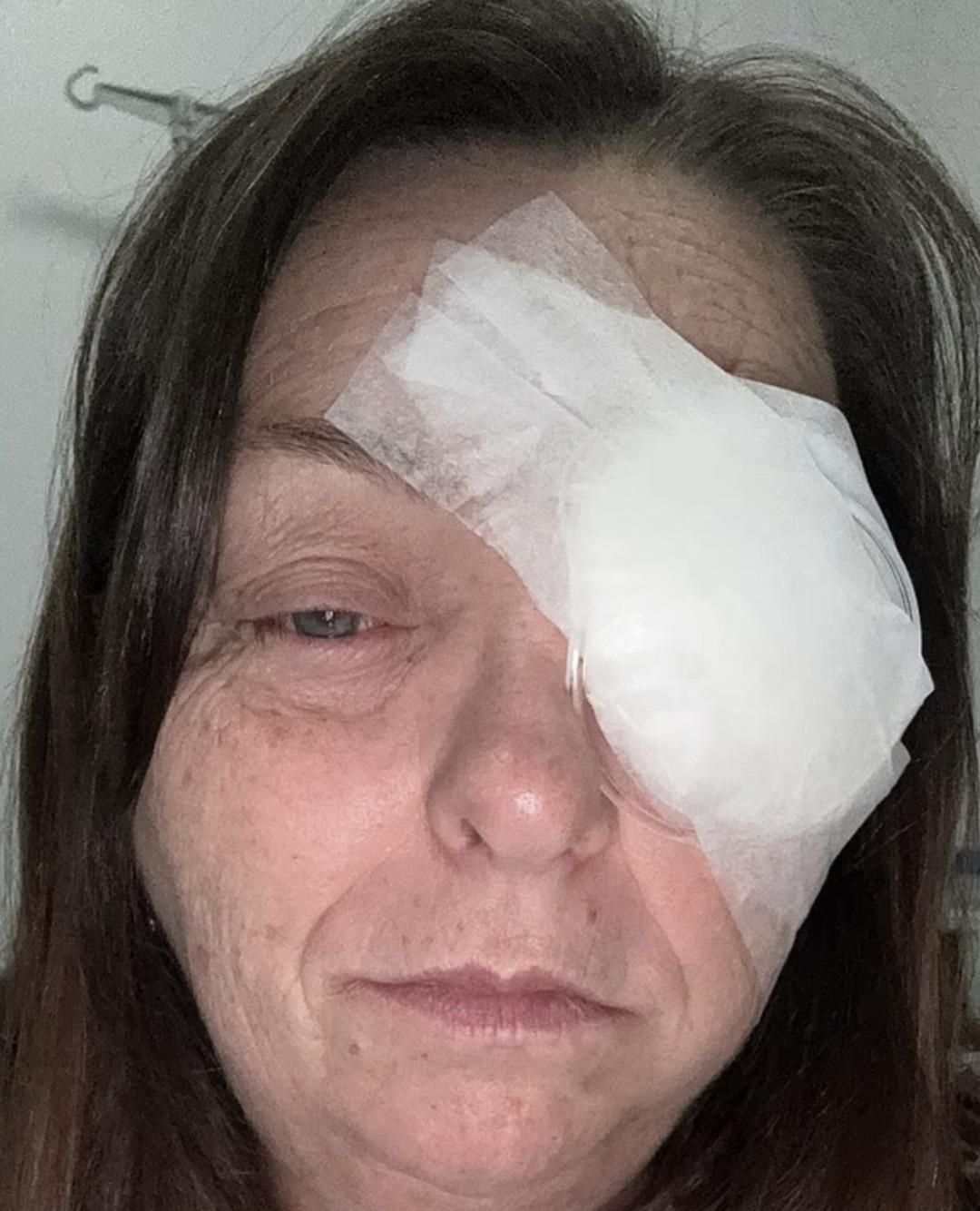 &Ccedil;ay yaparken fark etti: G&ouml;z&uuml;ndeki siyah noktayı sinek sandı, ger&ccedil;ek daha korkun&ccedil; &ccedil;ıktı!  4