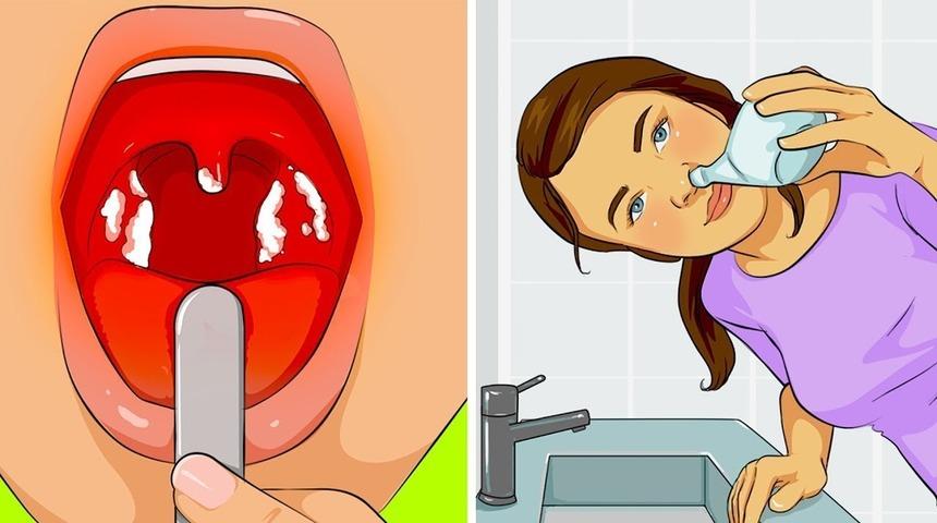 Yaygın enfeksiyonları ortadan kaldırmanın doğal yolları