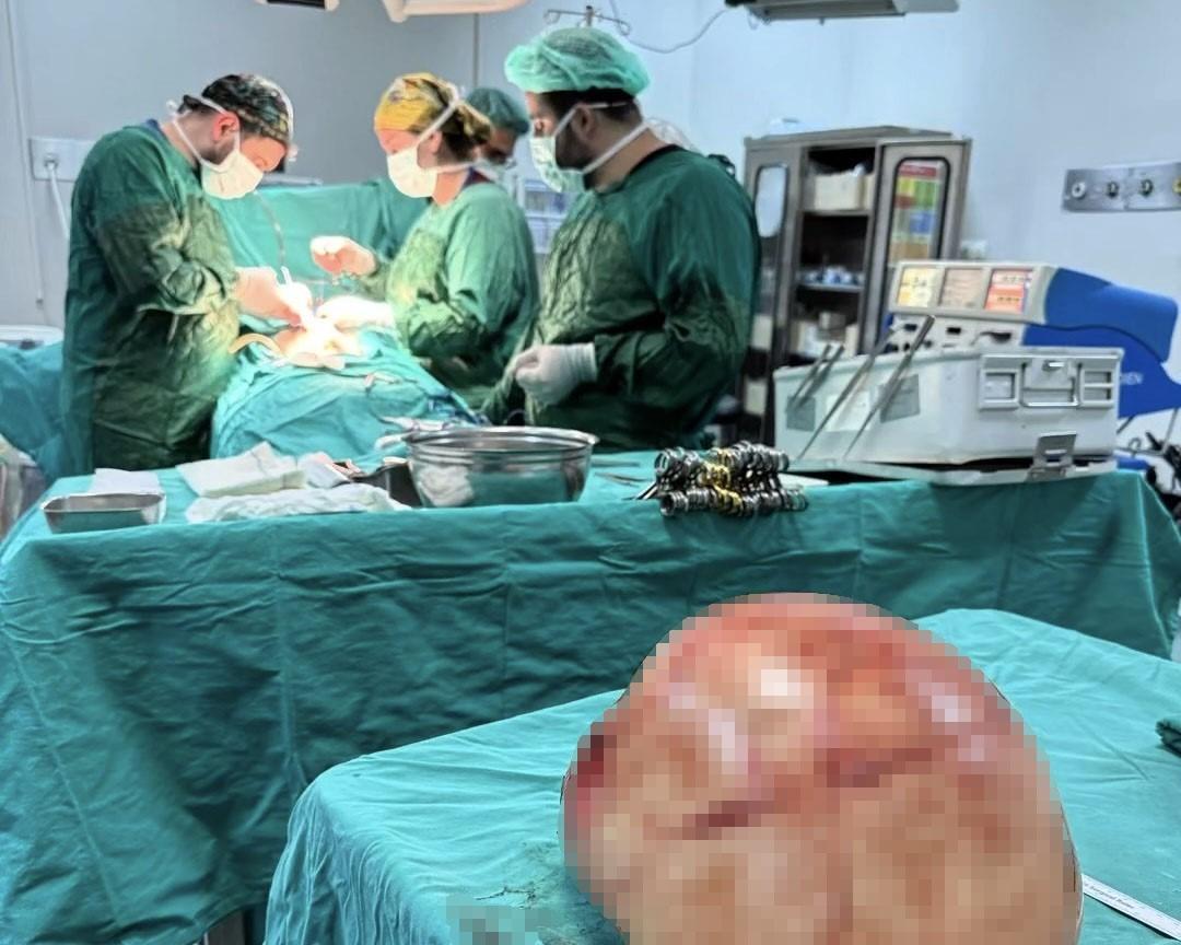 Karın ağrısı şikayetiyle gitti: 35 santimetrelik dev kitle &ccedil;ıkarıldı 2