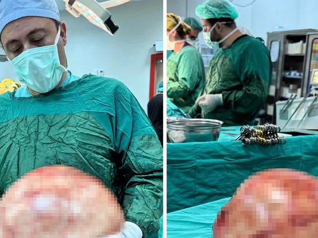 Karın ağrısı şikayetiyle gitti: 35 santimetrelik dev kitle &ccedil;ıkarıldı