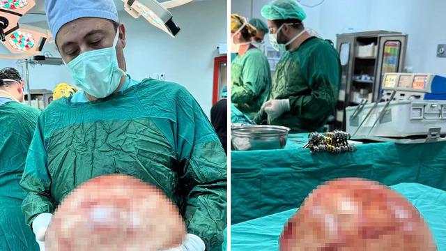 Karın ağrısı şikayetiyle gitti: 35 santimetrelik dev kitle çıkarıldı