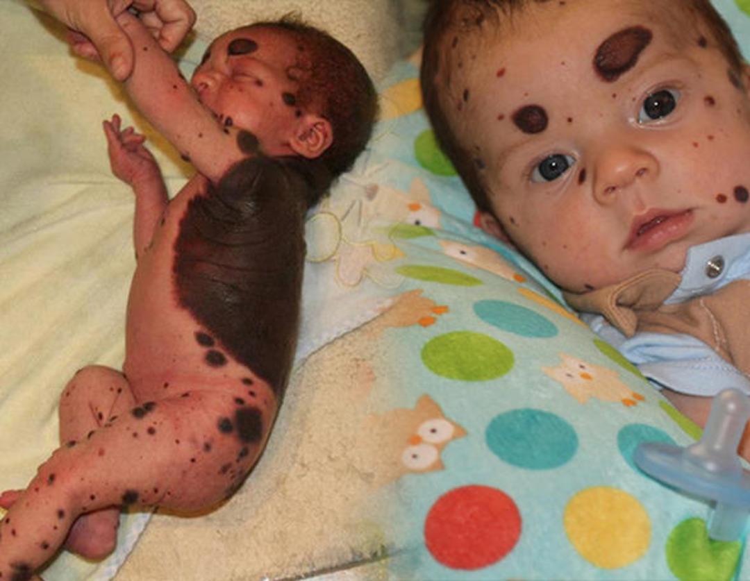 Bu halde d&uuml;nyaya geldi, doktorun s&ouml;yledikleri şoke etti