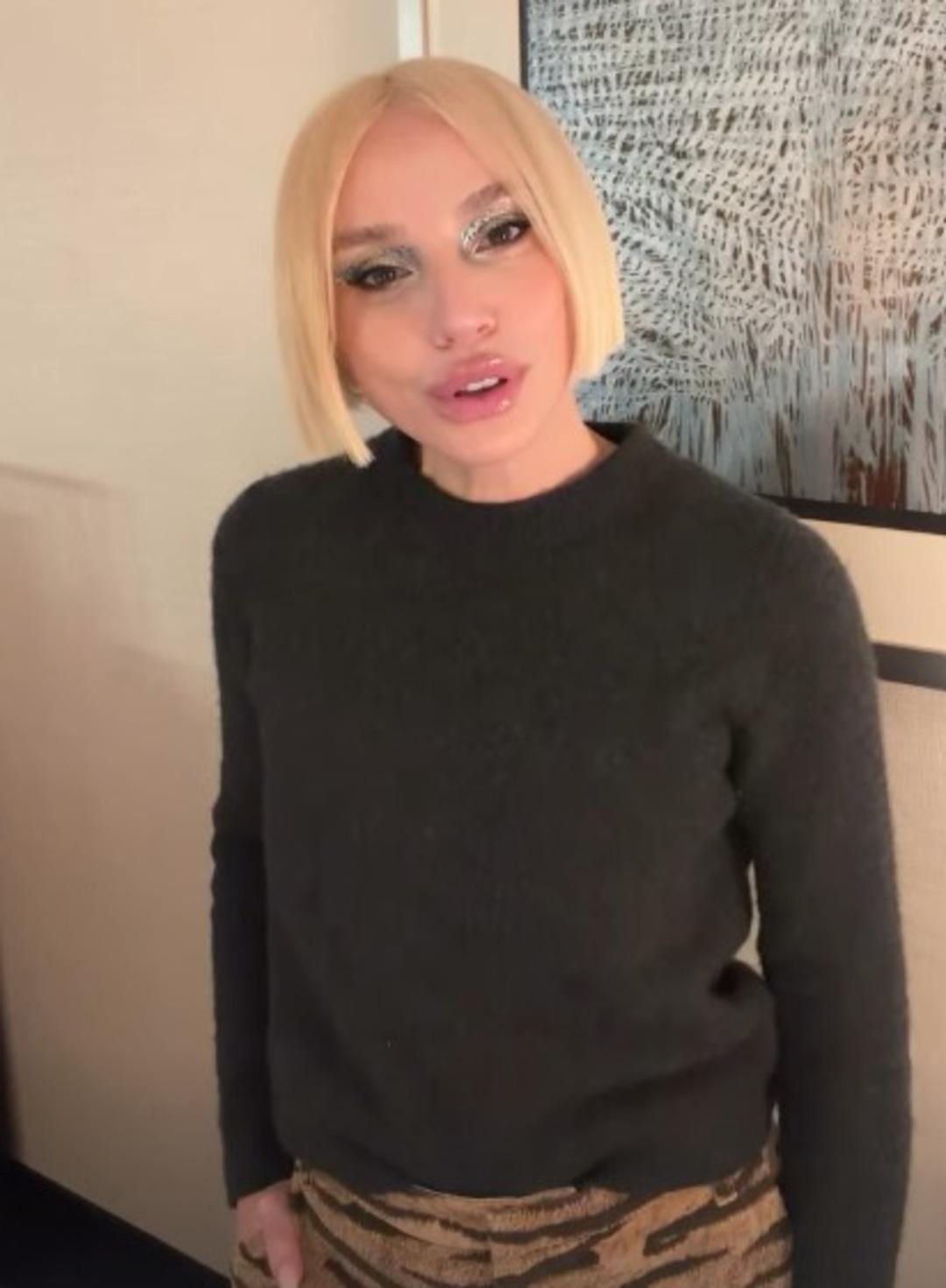 G&uuml;lşen in y&uuml;z&uuml;ndeki değişim dikkat &ccedil;ekti! Son haline kimse inanamadı 2