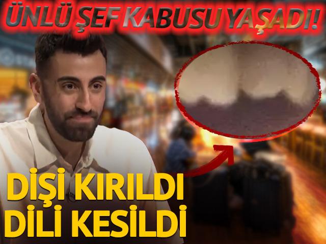 &Uuml;nl&uuml; şef kabusu yaşadı! Cam par&ccedil;aları dişini kırdı, dilini kesti