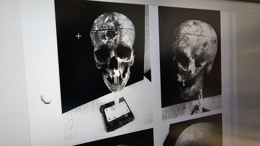 18 yıl sonra &ccedil;&ouml;z&uuml;len sır: &lsquo;Kirpi Ahmet&rsquo; cinayetinin gizemi &ccedil;&ouml;z&uuml;ld&uuml;! 3