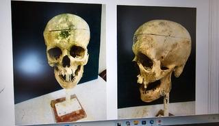 18 yıl sonra &ccedil;&ouml;z&uuml;len sır: Cinayetin gizemi &ccedil;&ouml;z&uuml;ld&uuml;!