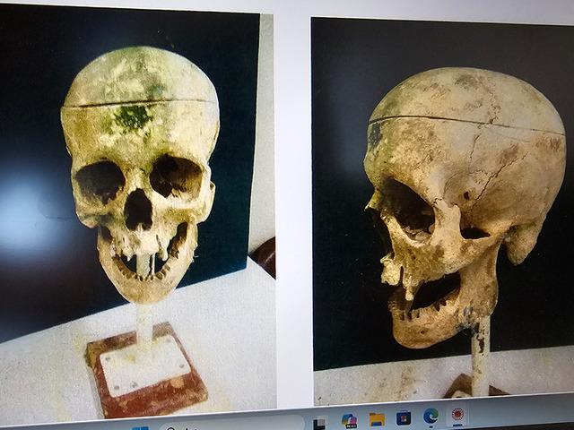 18 yıl sonra &ccedil;&ouml;z&uuml;len sır: &lsquo;Kirpi Ahmet&rsquo; cinayetinin gizemi &ccedil;&ouml;z&uuml;ld&uuml;!