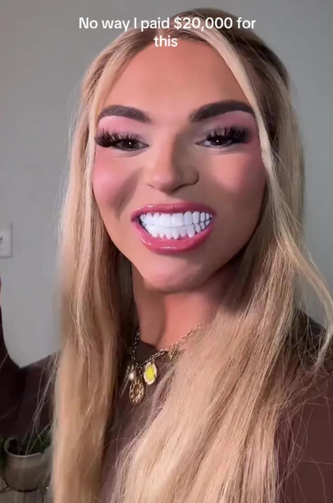 890 bin liraya yaptırdığı diş viral oldu: G&ouml;r&uuml;nt&uuml;s&uuml; ata benzetildi 2