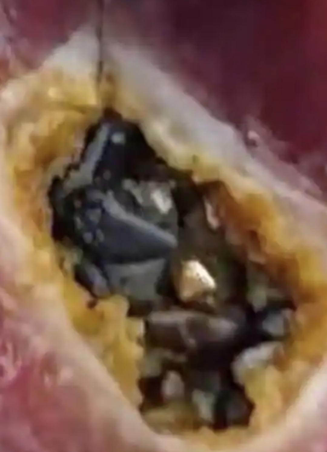 Beslediği &ouml;rdek altın yumurtlayan tavuk &ccedil;ıktı! Karnında &ccedil;il &ccedil;il altın taşıyormuş&nbsp; 3