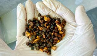 Altından daha değerli! Ciddi hastalıkların tedavisinde kullanılıyor