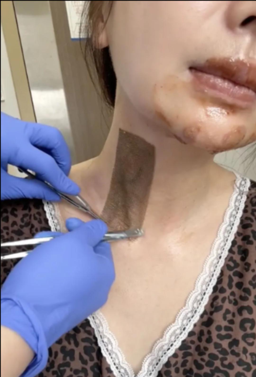 Viral pasta trendi doğum g&uuml;n&uuml;n&uuml; kabusa &ccedil;evirdi! 1500 derecede yandı 3