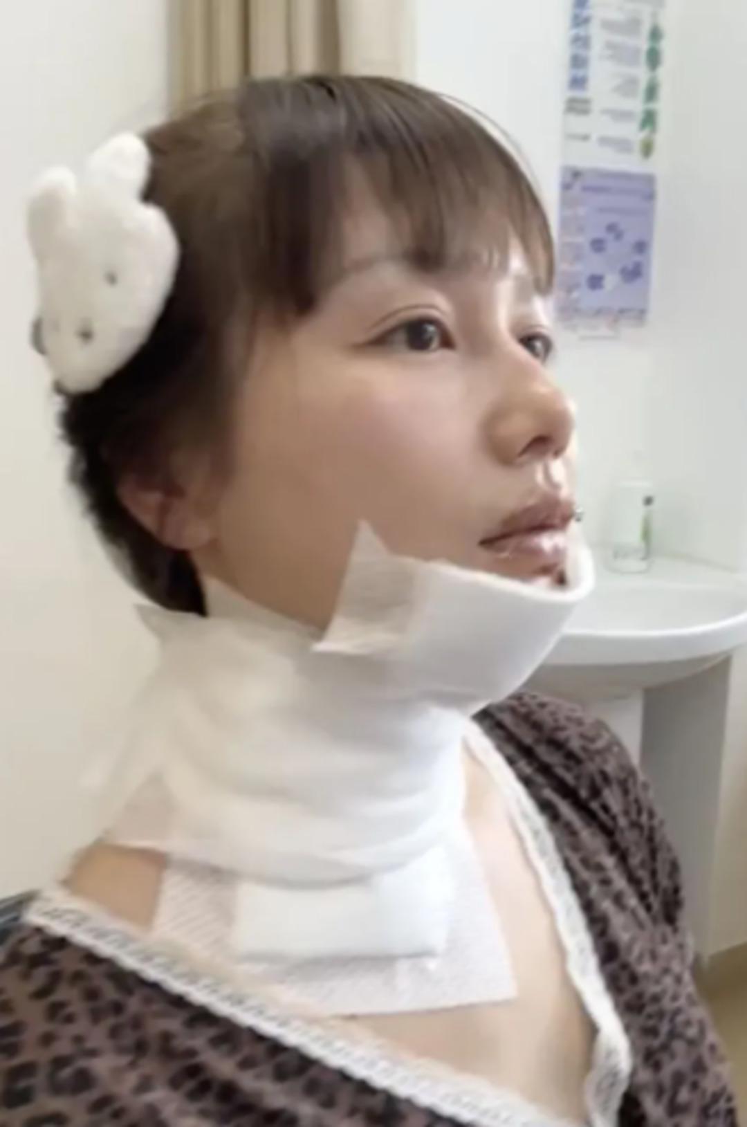 Viral pasta trendi doğum g&uuml;n&uuml;n&uuml; kabusa &ccedil;evirdi! 1500 derecede yandı 4