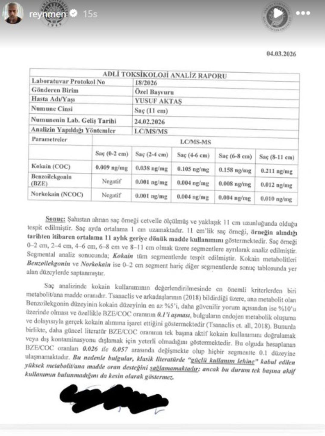 Yeniden test yaptırdı! Reynmen in uyuşturucu testi sonucu &ccedil;ıktı 3