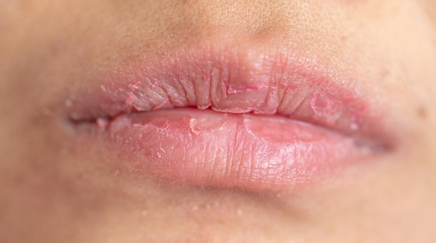 S&uuml;rekli dudaklarınızı mı yiyorsunuz? Bakın altında yatan psikolojik sebep ne &ccedil;ıktı
