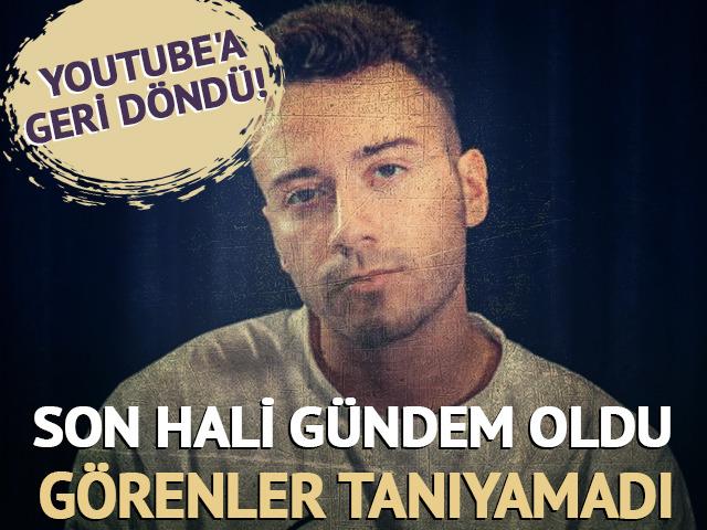 Zor g&uuml;nleri geride bıraktı! Son hali g&uuml;ndem oldu