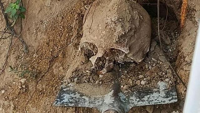 Bahçede yapılan kazıda insan kafatası ve kemikler bulundu