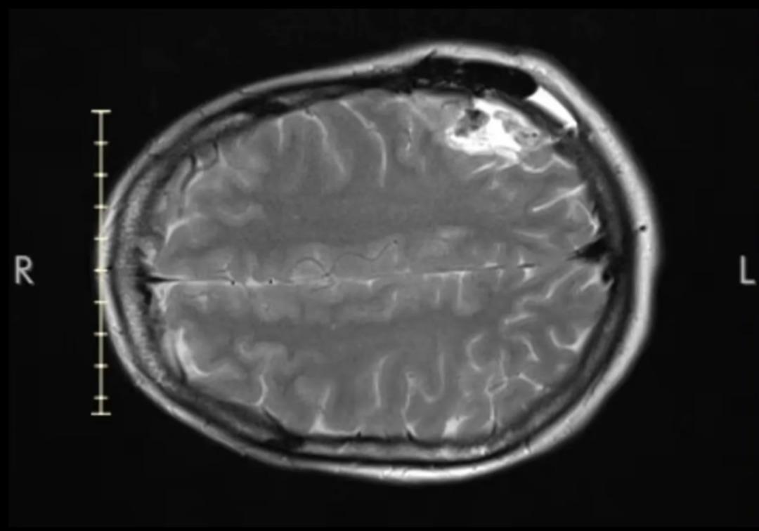 Trende başına valiz düşünce gerçek ortaya çıktı! Meğerse beyninde... 3