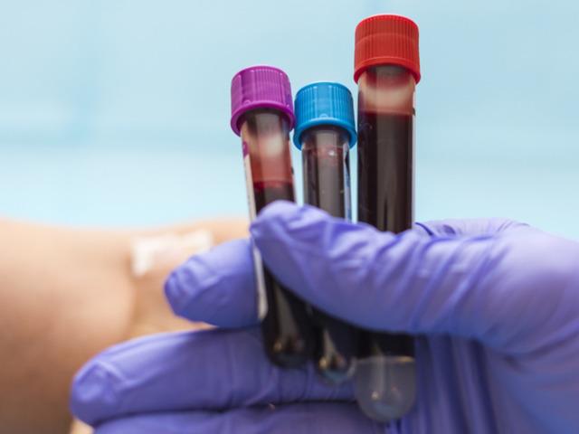 Kan grubunuz hangi hastalıklara yatkın olduğunuzu s&ouml;yl&uuml;yor