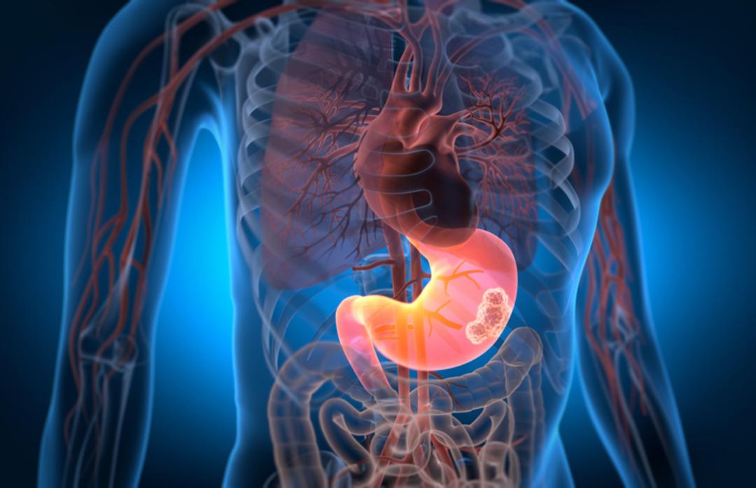 En riskli kan grubu ortaya &ccedil;ıktı! Kalp krizi ihtimali daha y&uuml;ksek 3