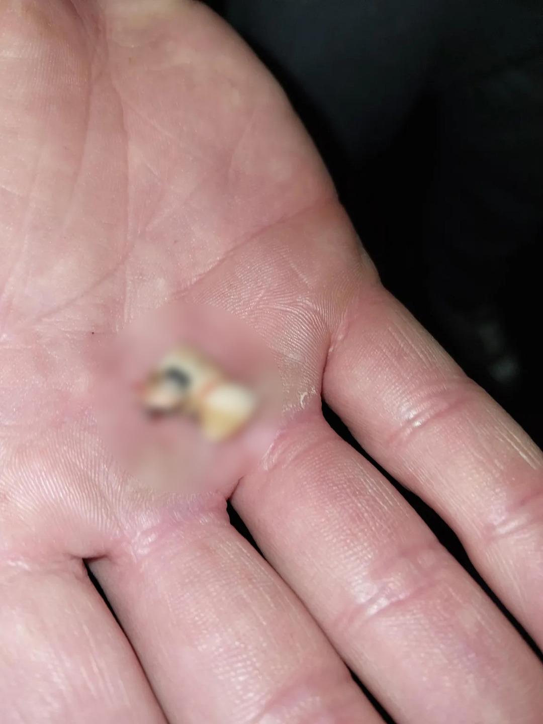 Komşusundan sessiz olmasını isteyince kabusu yaşadı! Sa&ccedil;larını yolup, dişlerini kırdı 3