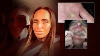 Komşusundan sessiz olmasını isteyince kabusu yaşadı! Saçlarını yolup, dişlerini kırdı