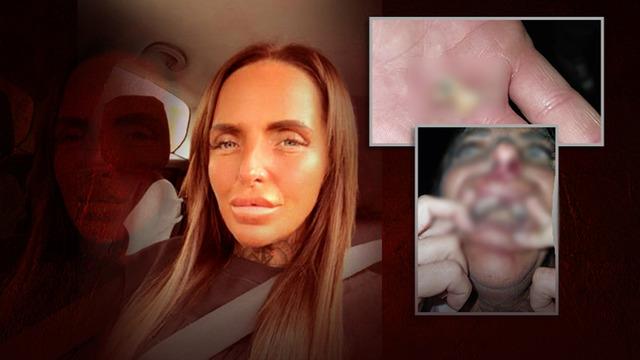 Komşusundan sessiz olmasını isteyince kabusu yaşadı! Saçlarını yolup, dişlerini kırdı