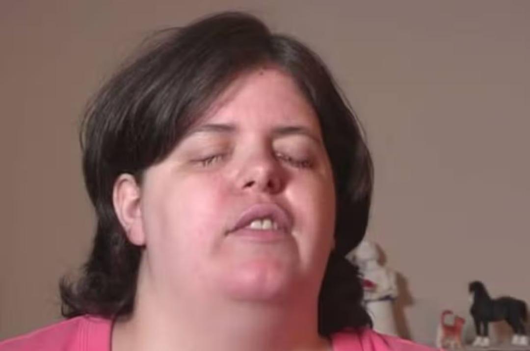 Kendini psikolog olarak tanıtıp kadının g&ouml;zlerine deterjan enjekte etti! 2