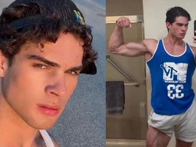 G&uuml;zellik uğruna kendine &ccedil;eki&ccedil;le vurdu! Kısır kaldı