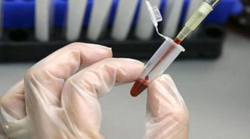 Öyle bir kanser gerçeği ortaya çıktı ki...