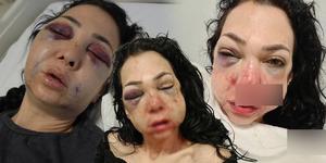 Anne ve oğlunu feci şekilde darp ettiler! Tanınmaz hale geldi: "Tehdit ediliyorum"