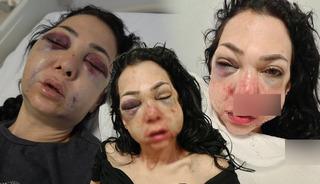 Anne ve oğlunu feci şekilde darp ettiler! Tanınmaz hale geldi: "Tehdit ediliyorum"