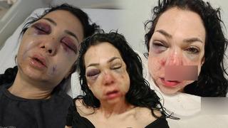 Yer: Kocaeli! Anne ve oğlunu feci şekilde darp ettiler! Tanınmaz hale geldi: Tehdit ediliyorum