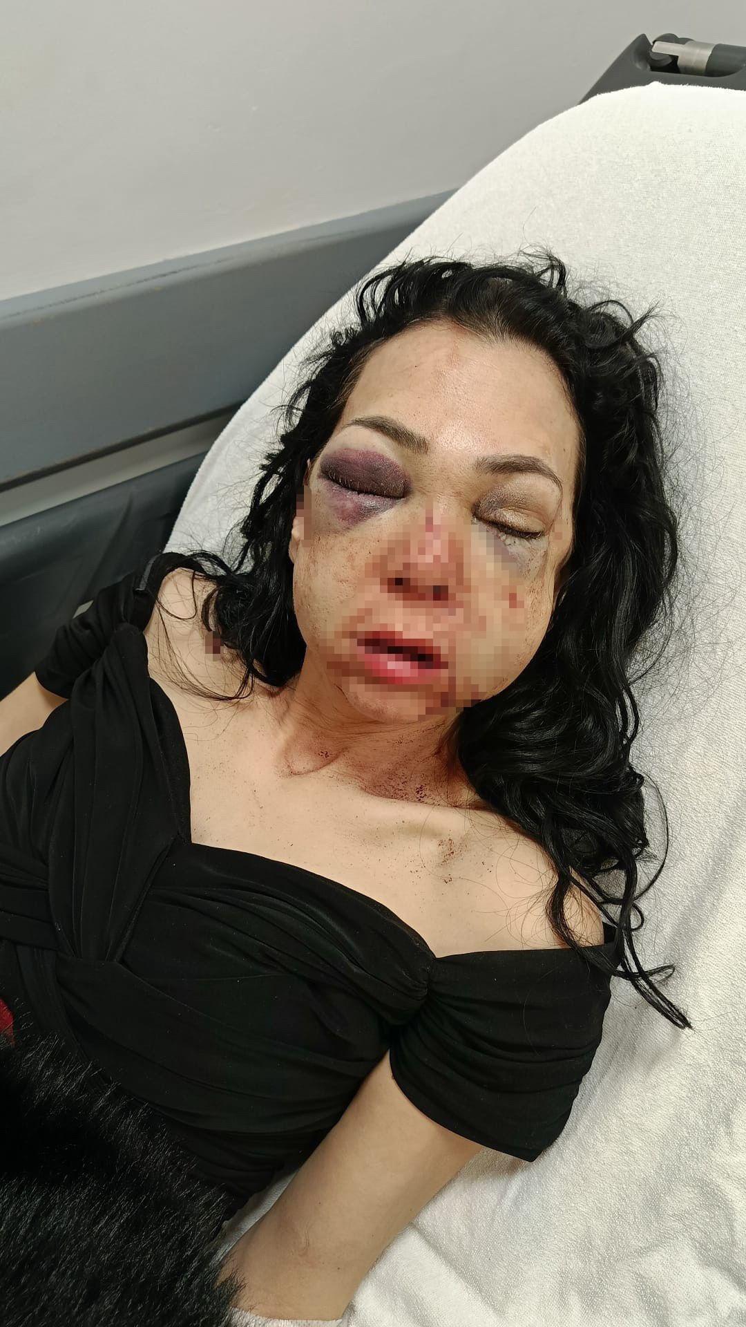 Yer: Kocaeli! Anne ve oğlunu feci şekilde darp ettiler! Tanınmaz hale geldi: "Tehdit ediliyorum" 3