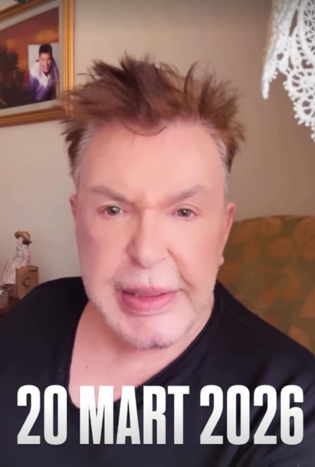 Kuşum Aydın y&uuml;z&uuml;ndeki dolgulardan kurtuldu! İşte son hali 1